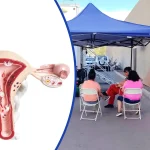 Refuerzan Prevención Del Cáncer Cervicouterino En Mujeres Privadas De Libertad En Arica